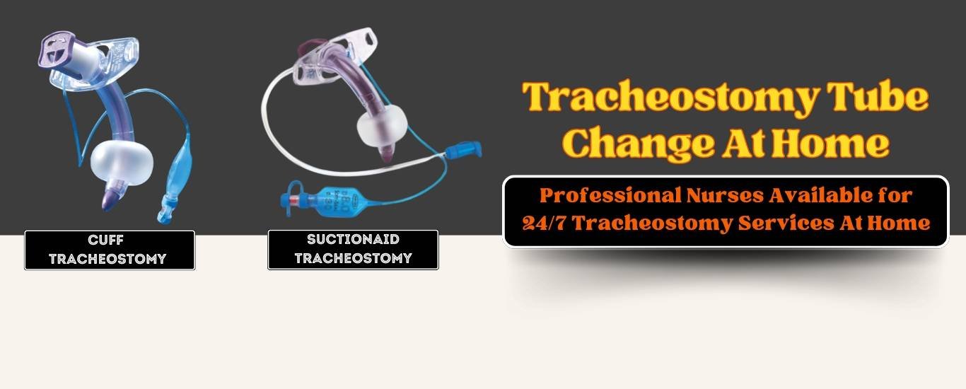 Need Tracheostomy Tube Insertion At Home In Delhi